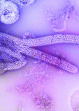 Ebola