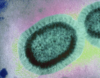 Influenza